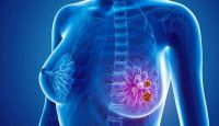 A CBD sejthalált idéz elő mellrák sejtekben